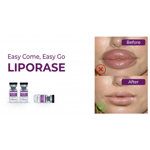 Liporase- Filler Dissolvant